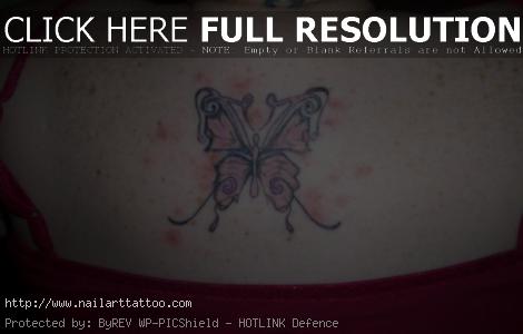 allergic reaction to tattoo
