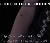 avril lavigne tattoo removed