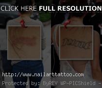 brody jenner tattoo removal