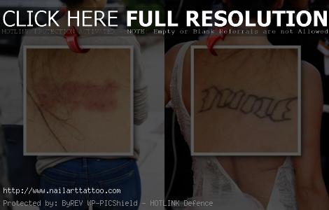 brody jenner tattoo removal